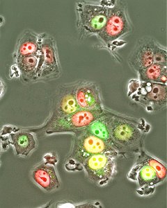 Human cancer cells