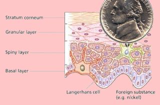 Layers of the skin and is immunity mechanism.